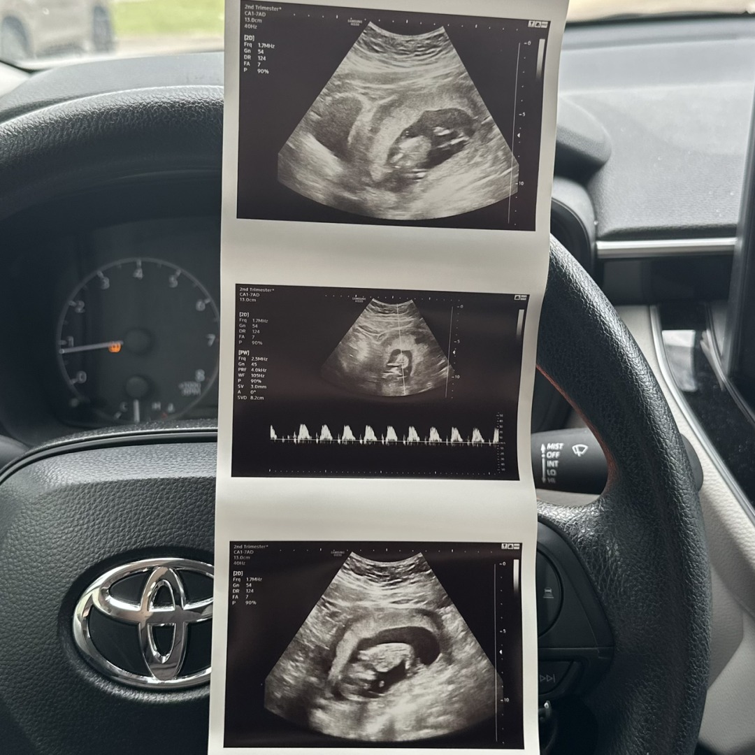 Photo shared by Nicole for their Babylist baby registry.