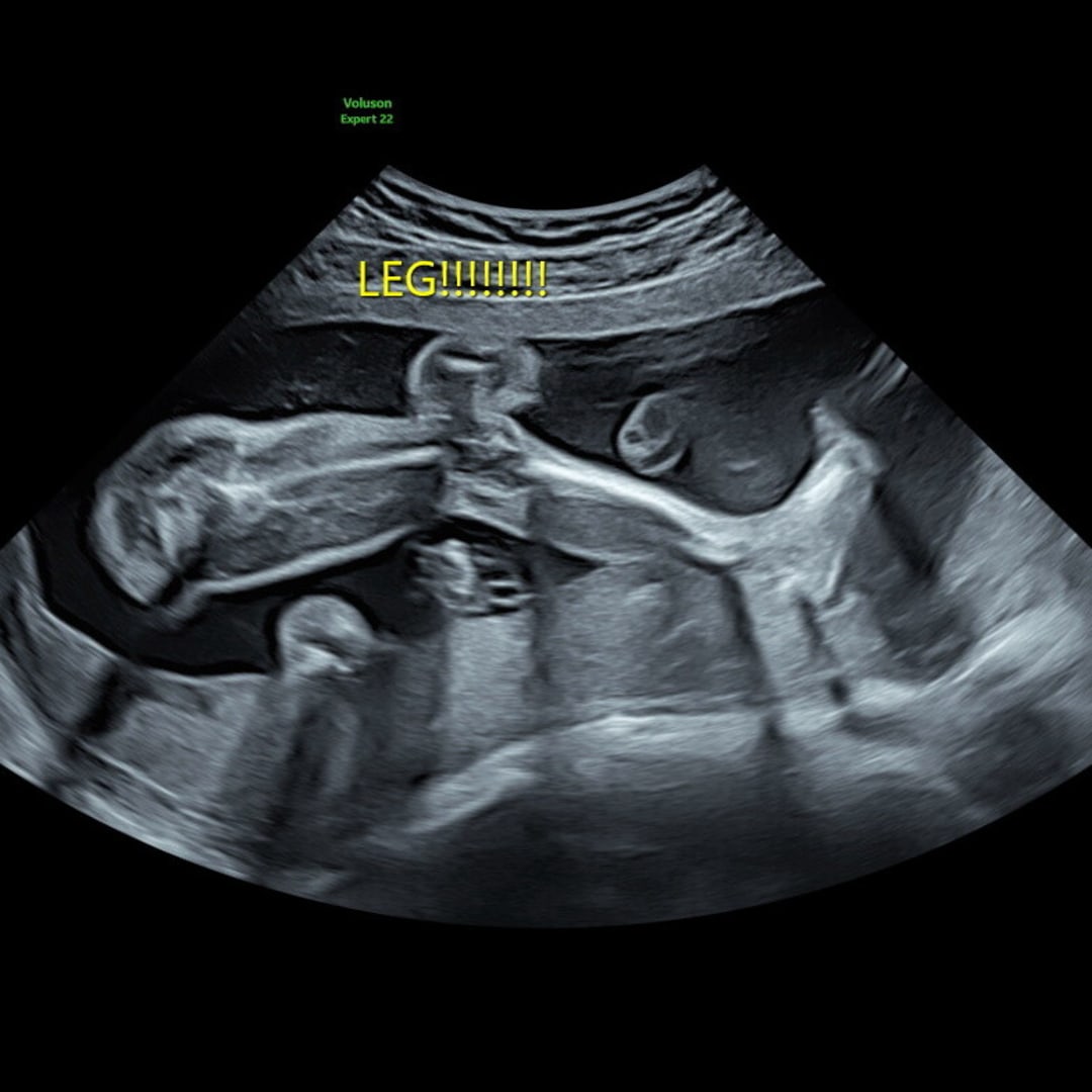 Photo shared by Nikia for their Babylist baby registry.