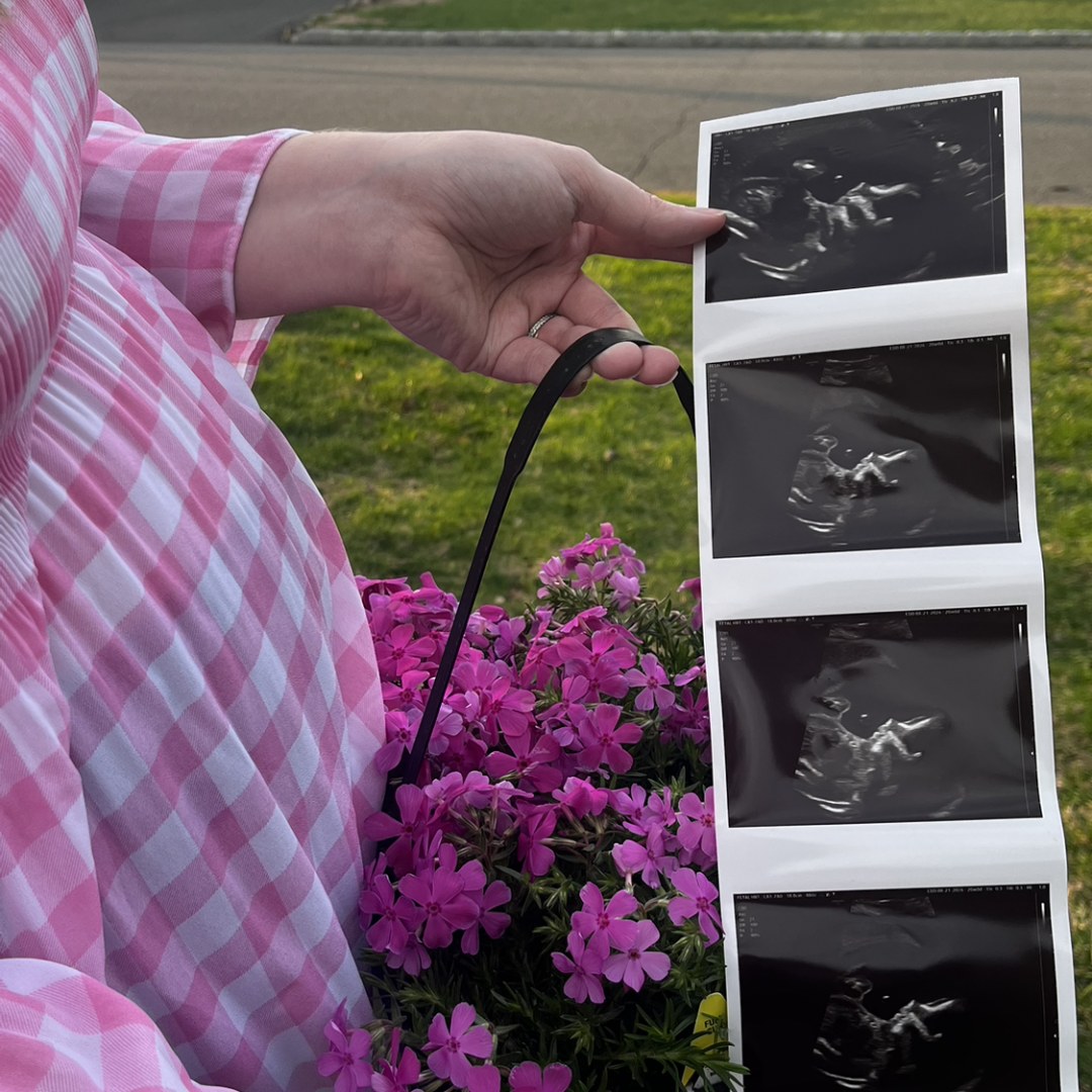 Photo shared by Jaci for their Babylist baby registry.