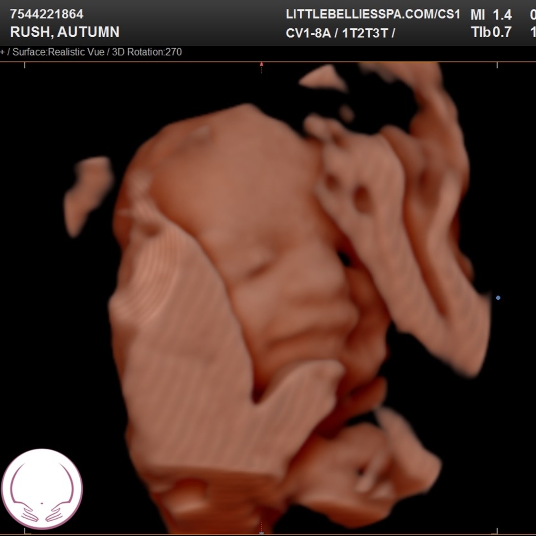 Photo shared by Autumn for their Babylist baby registry.