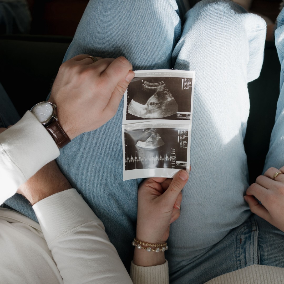 Photo shared by Areta for their Babylist baby registry.