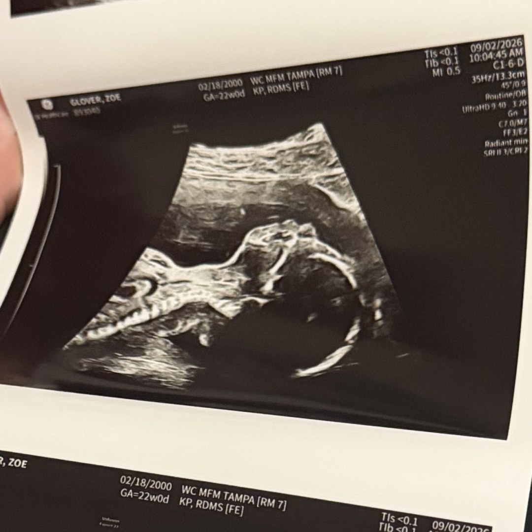Photo shared by Zoe for their Babylist baby registry.