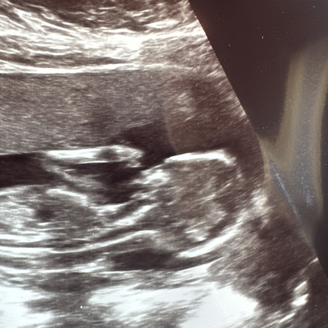Photo shared by Alexias for their Babylist baby registry.