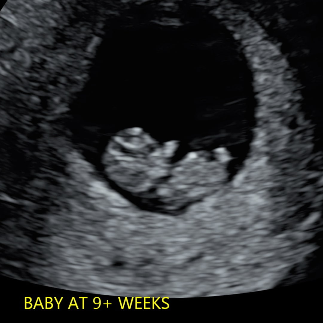Photo shared by Lidiana for their Babylist baby registry.