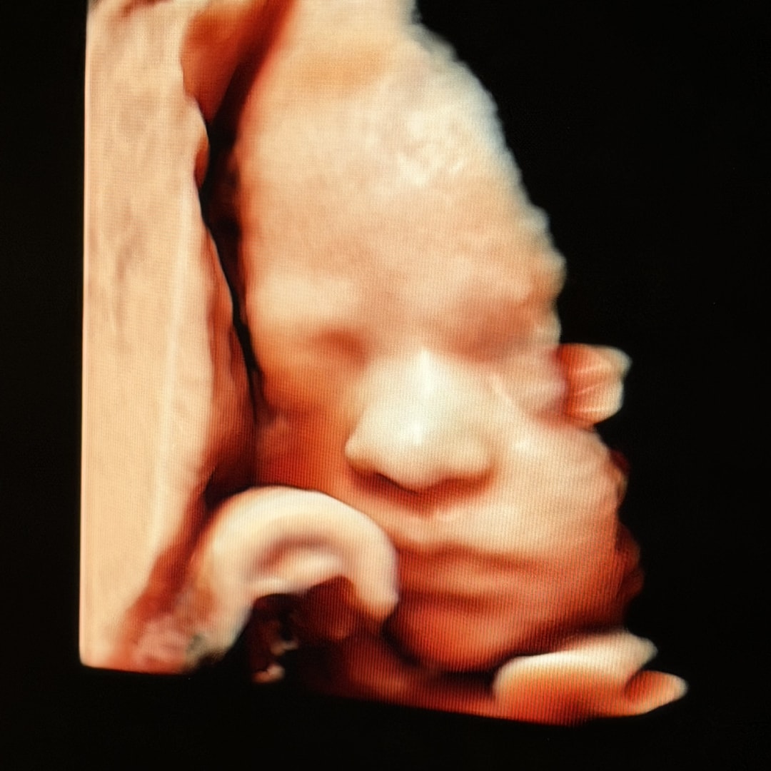 Photo shared by Haylea for their Babylist baby registry.