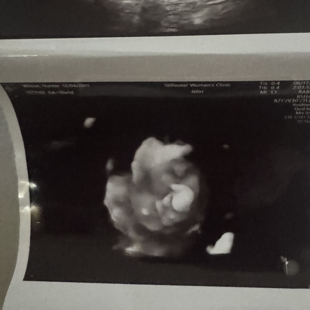 Photo shared by Hunter for their Babylist baby registry.