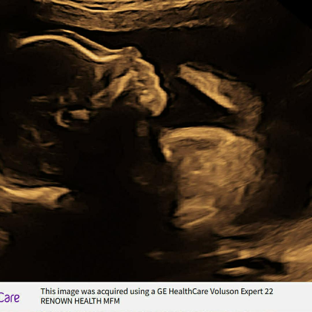 Photo shared by Eva for their Babylist baby registry.