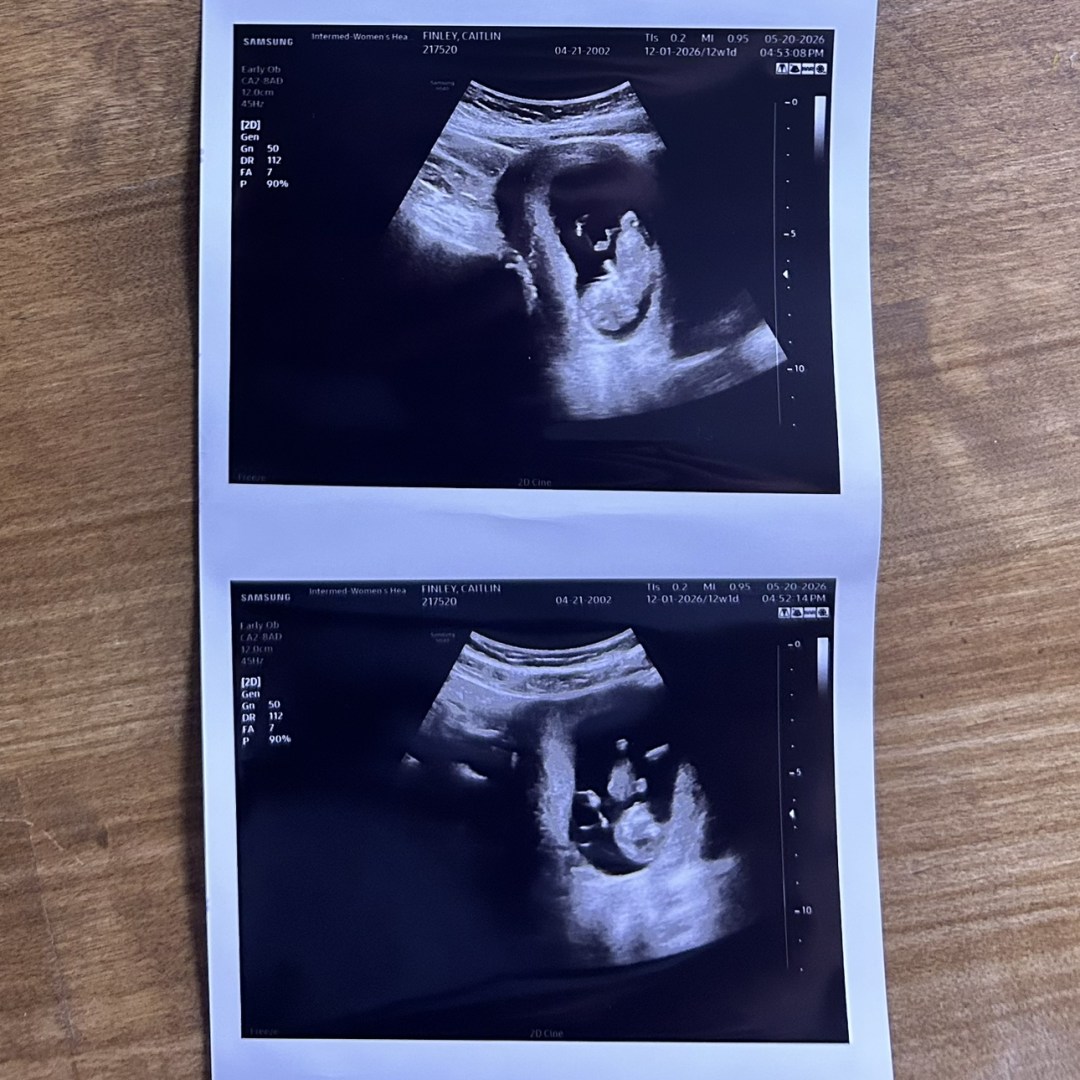 Photo shared by Caitlin for their Babylist baby registry.