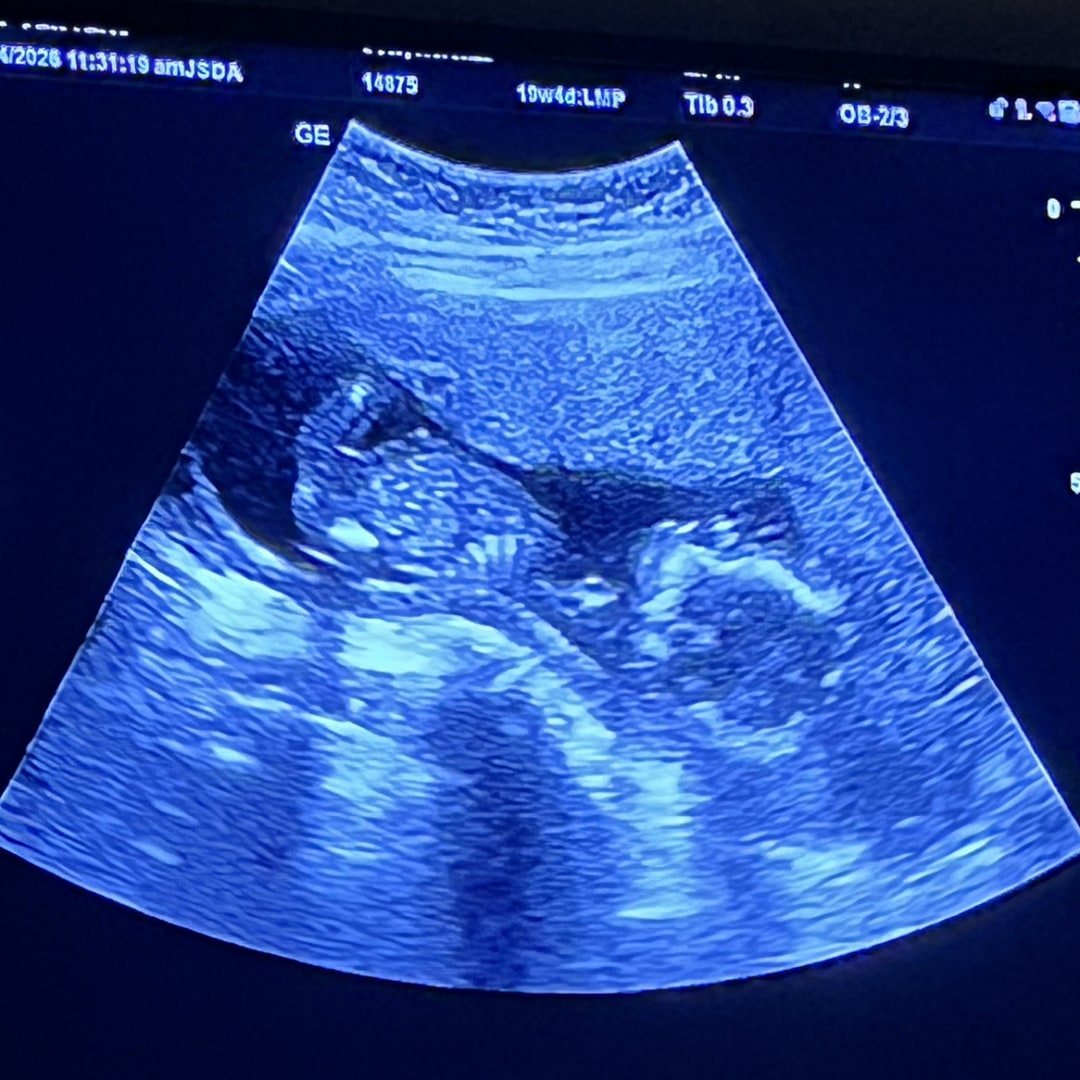Photo shared by Kerenza for their Babylist baby registry.