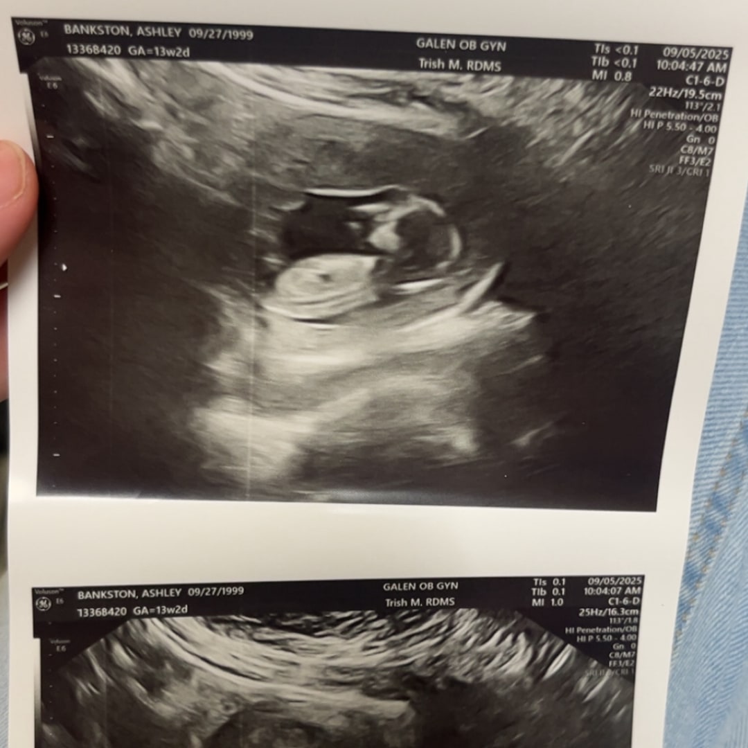 Photo shared by Ashley for their Babylist baby registry.