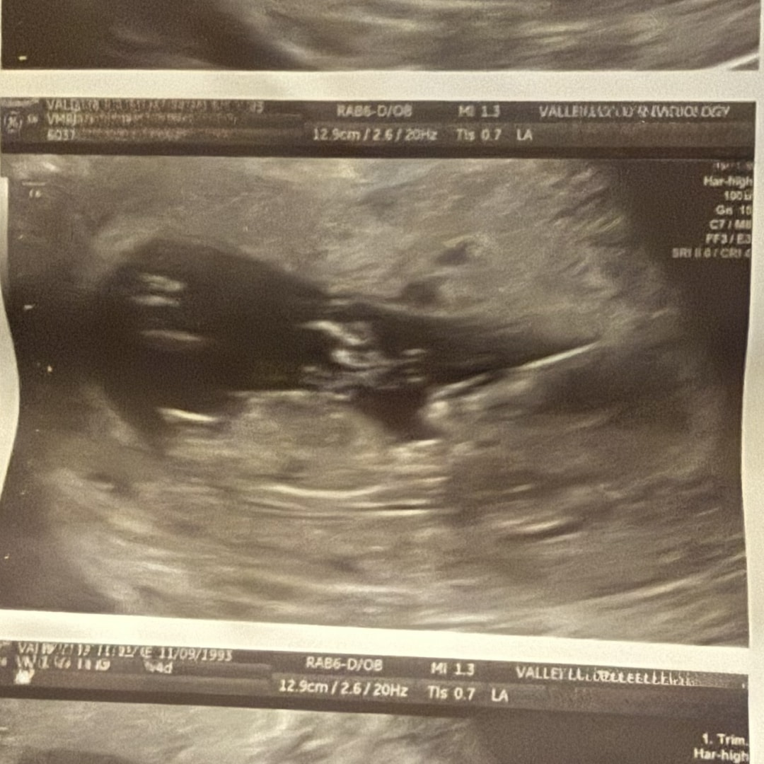 Photo shared by Jacqueline for their Babylist baby registry.