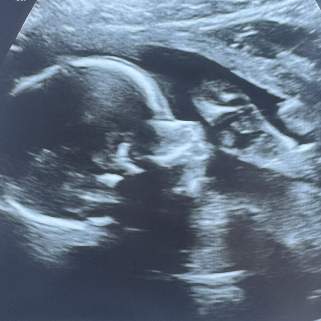 Photo shared by Amber for their Babylist baby registry.