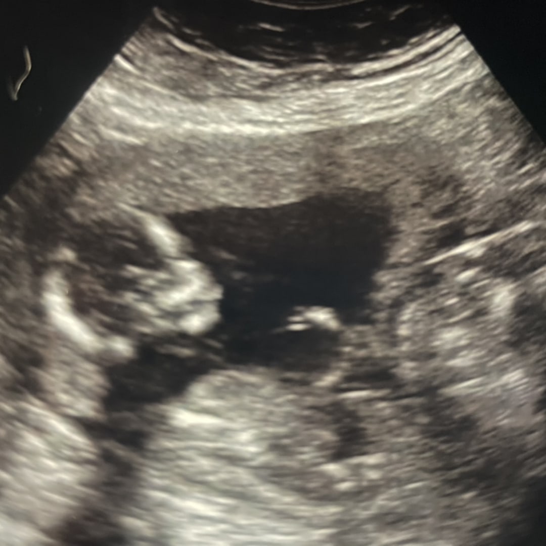 Photo shared by Haleigh for their Babylist baby registry.