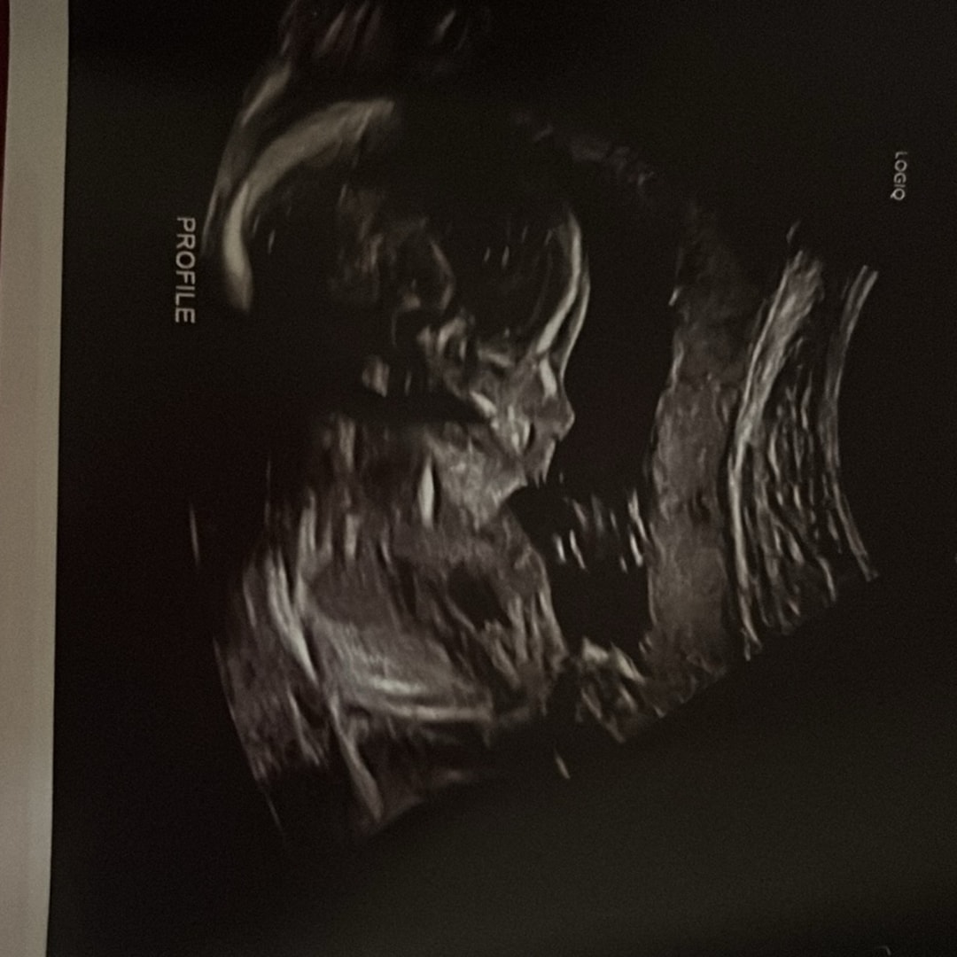 Photo shared by Abby for their Babylist baby registry.