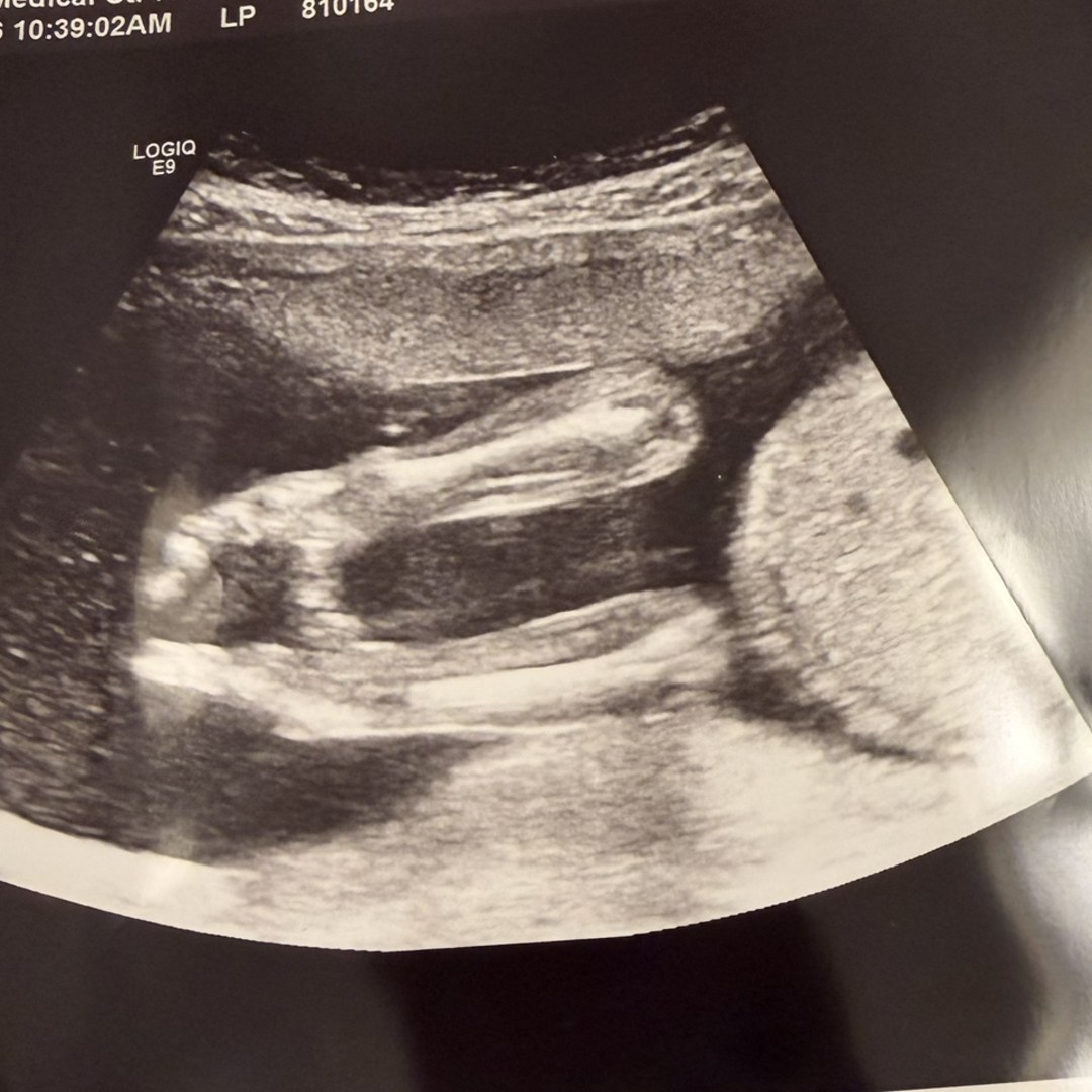 Photo shared by Myah for their Babylist baby registry.