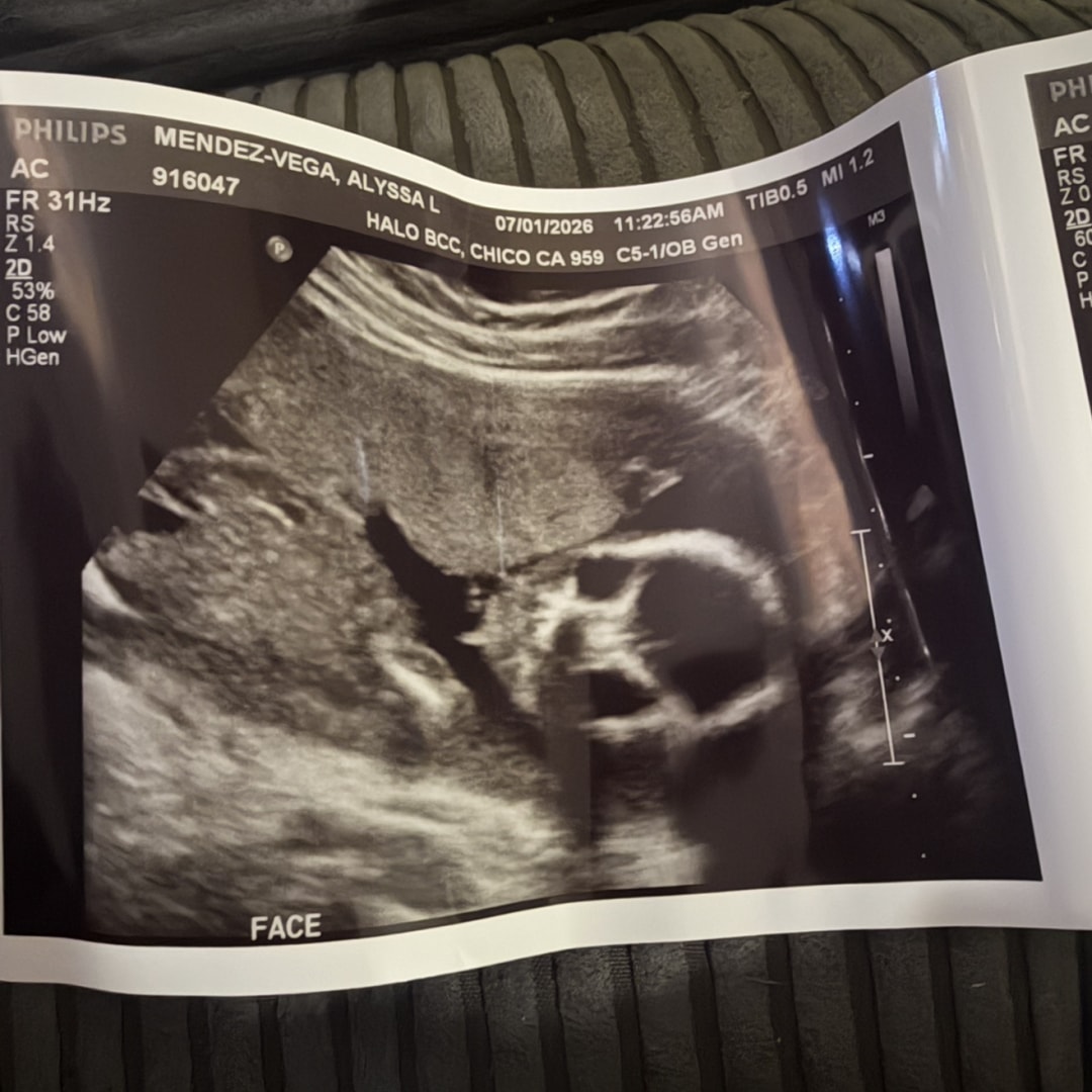 Photo shared by Alyssa for their Babylist baby registry.
