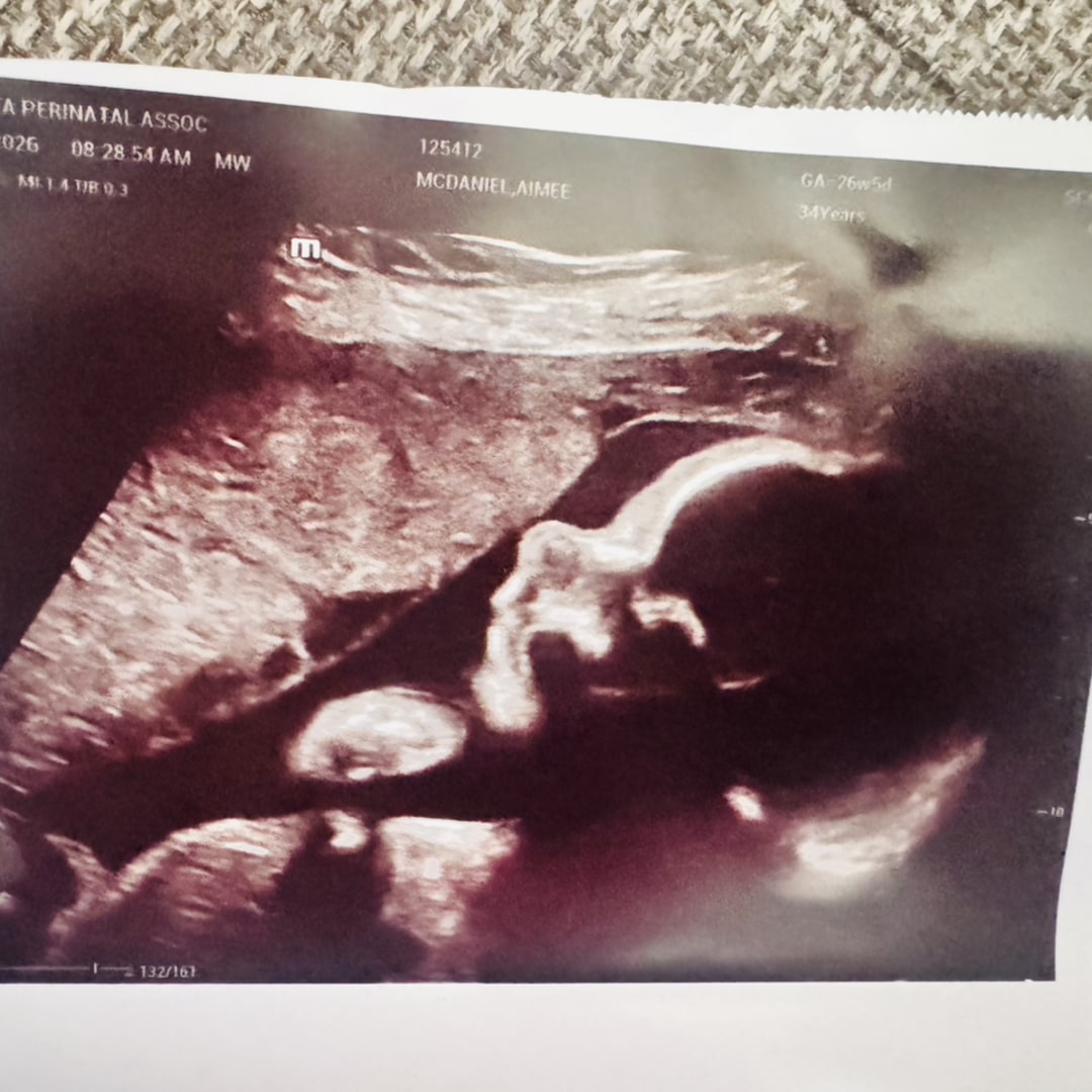 Photo shared by Aimee for their Babylist baby registry.