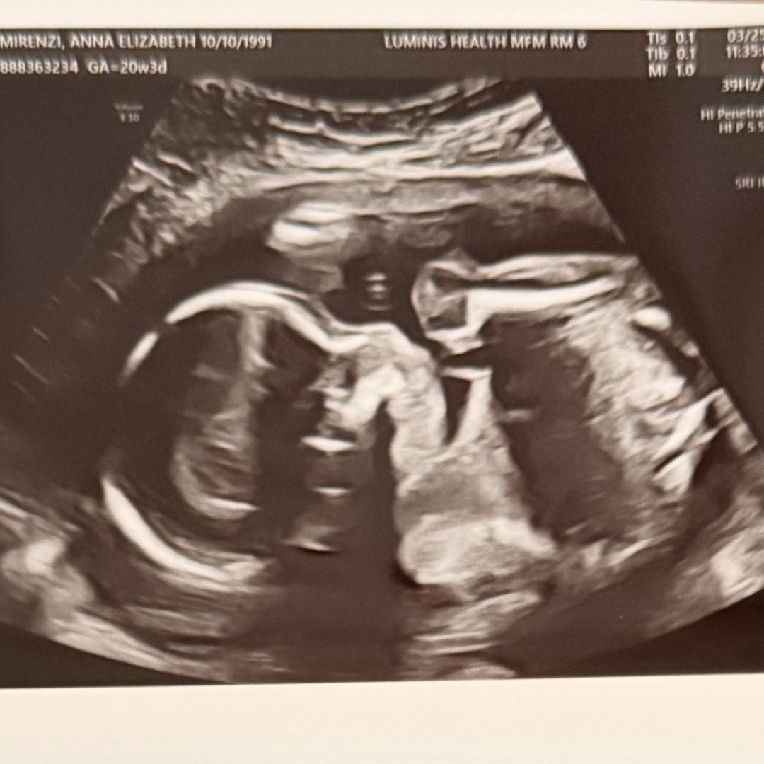 Photo shared by Anna & Cara for their Babylist baby registry.