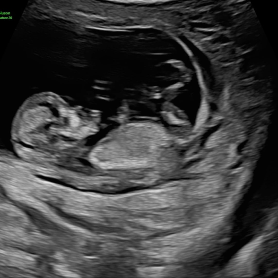 Photo shared by Shelby for their Babylist baby registry.