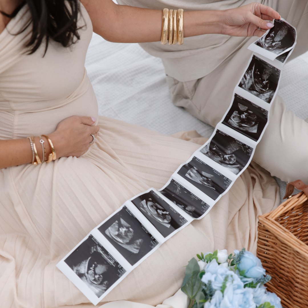 Photo shared by Summer for their Babylist baby registry.