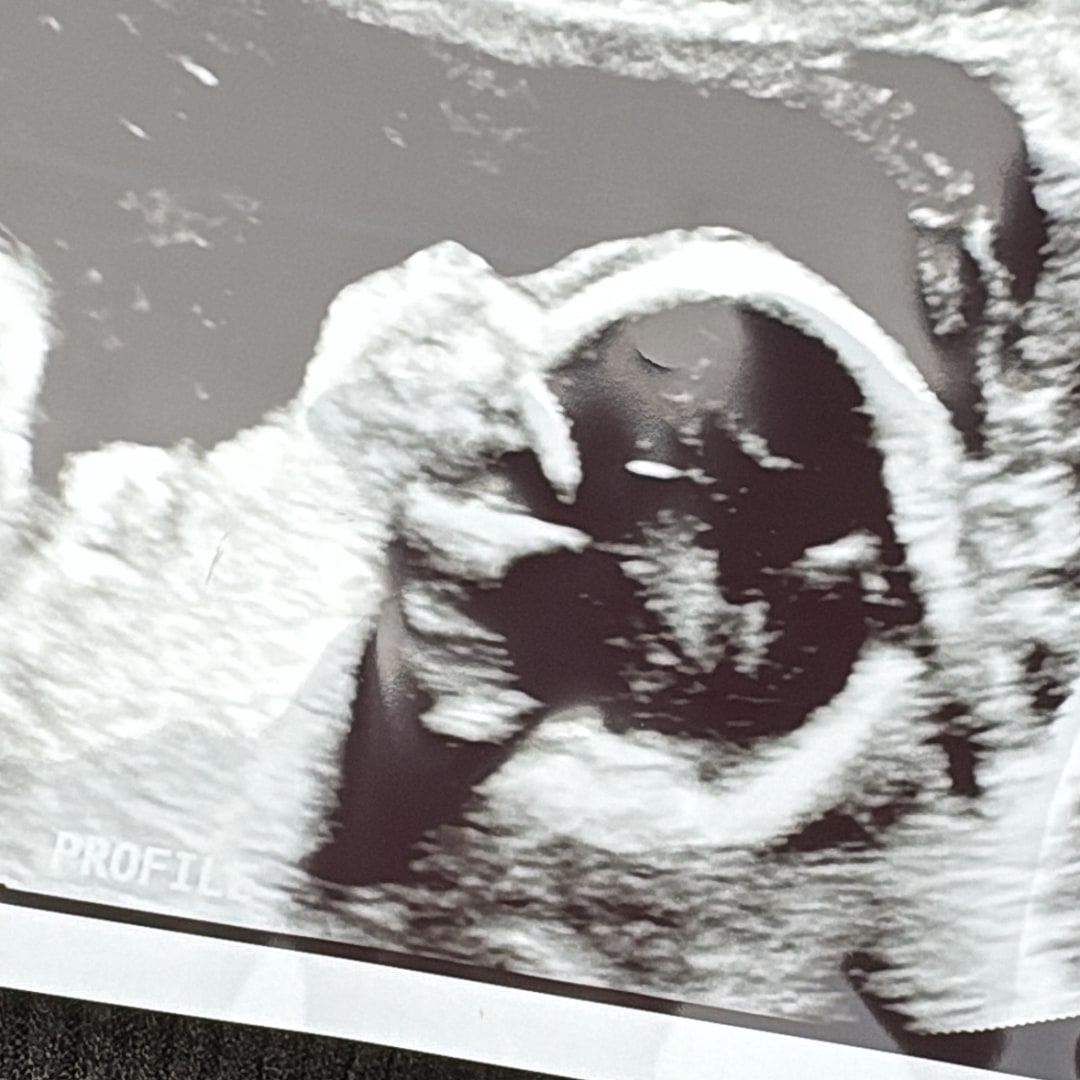 Photo shared by Kelsey for their Babylist baby registry.