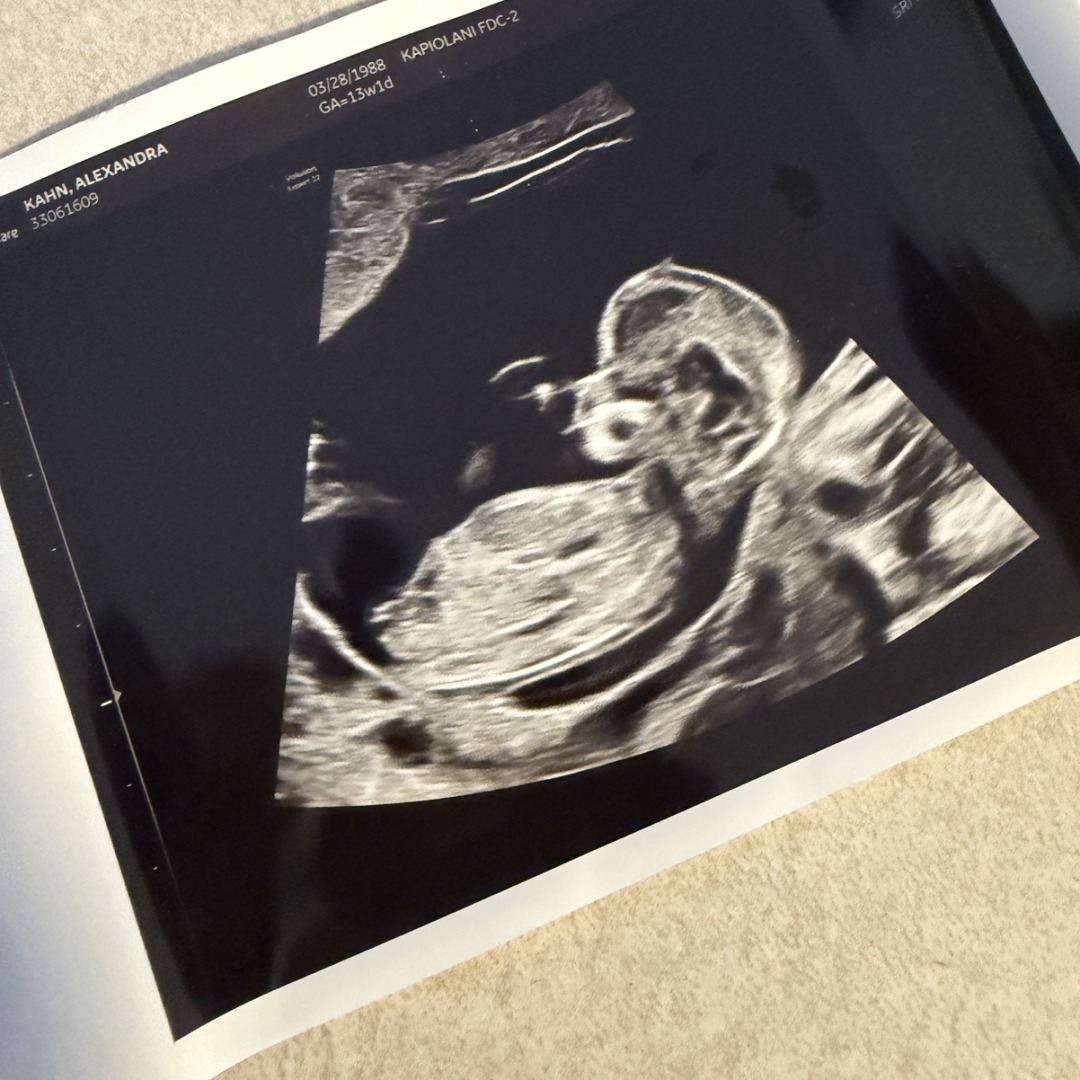 Photo shared by Alexandra for their Babylist baby registry.