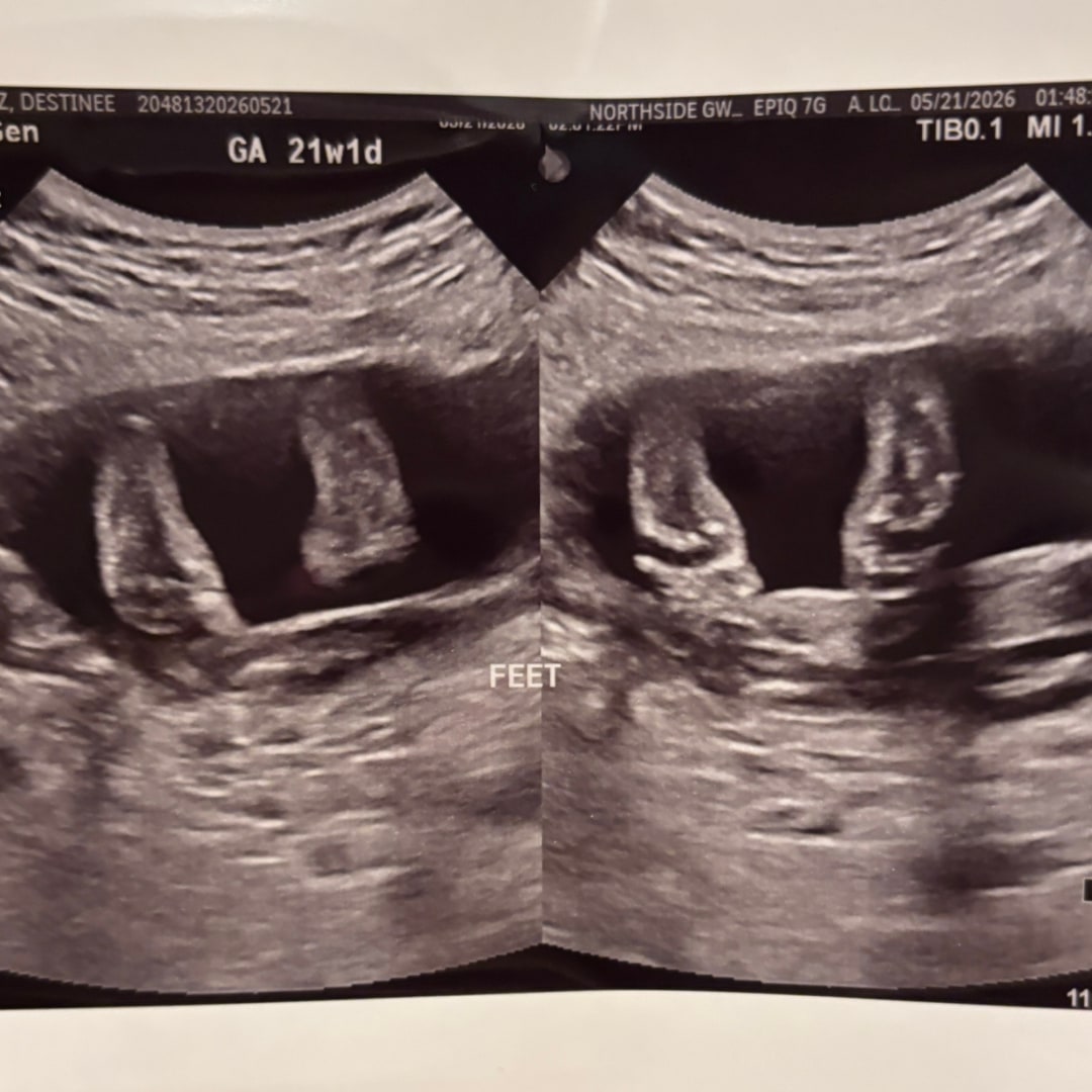 Photo shared by Destinee for their Babylist baby registry.