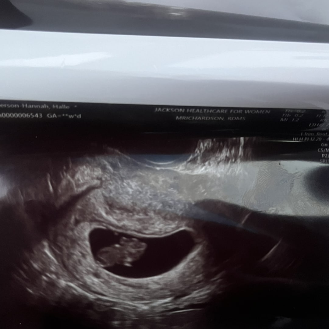 Photo shared by Halle for their Babylist baby registry.