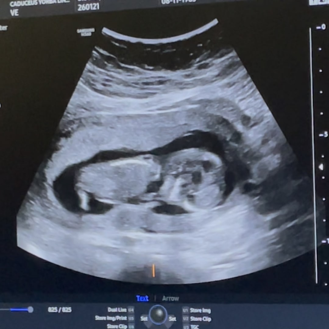 Photo shared by Nicolle for their Babylist baby registry.