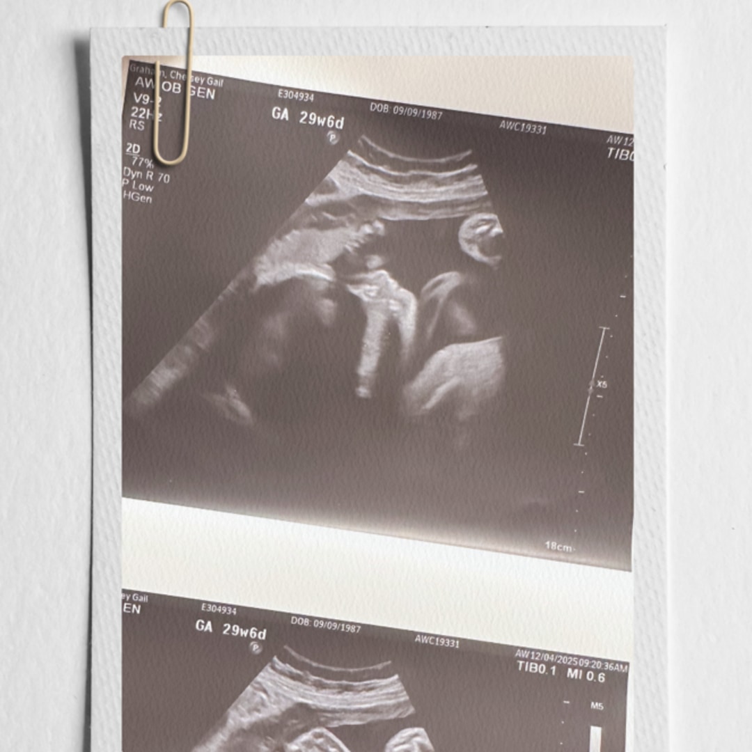 Photo shared by Chelsey for their Babylist baby registry.