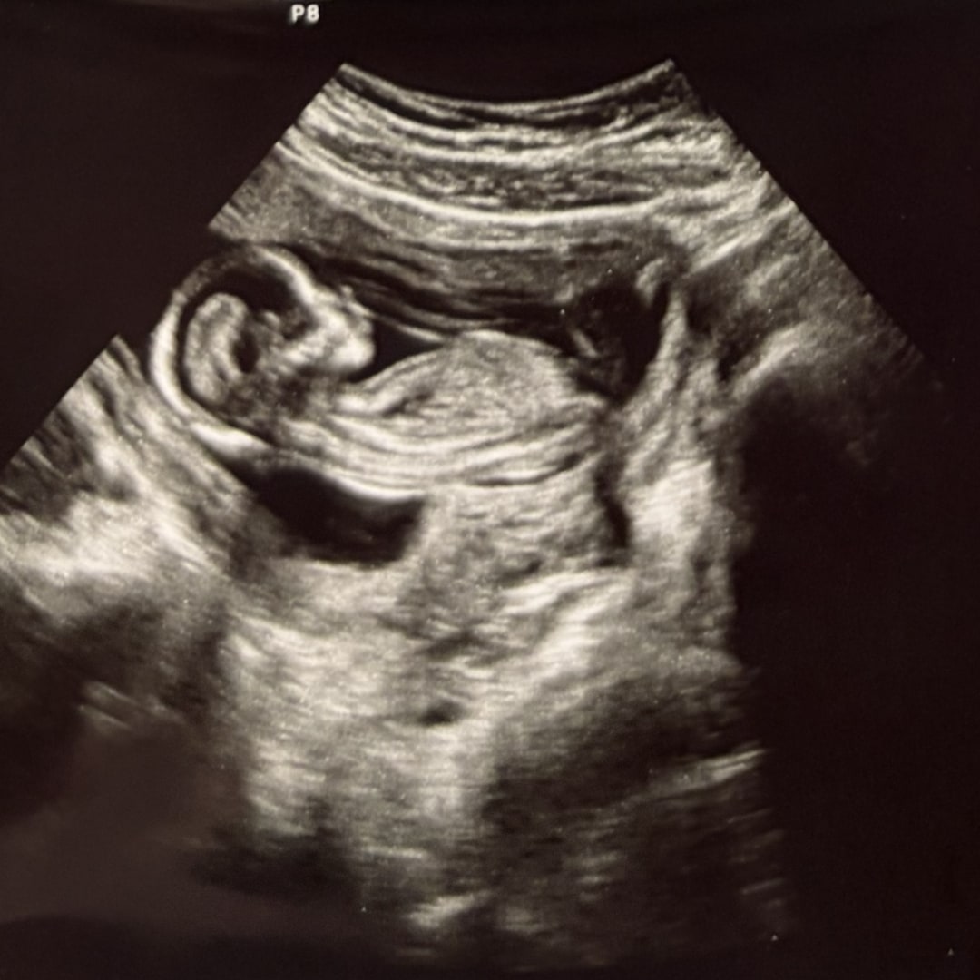Photo shared by Breanna for their Babylist baby registry.