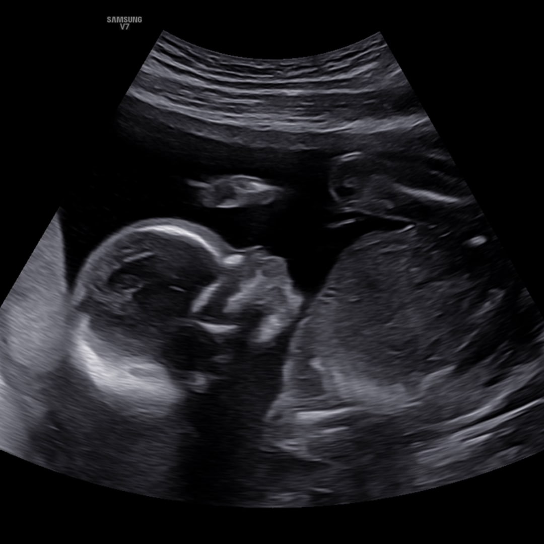 Photo shared by Althea for their Babylist baby registry.