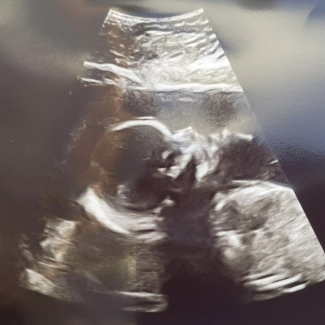 Photo shared by Kelly for their Babylist baby registry.