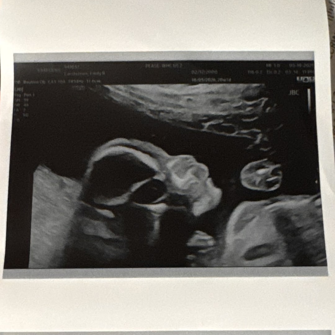 Photo shared by Emily for their Babylist baby registry.