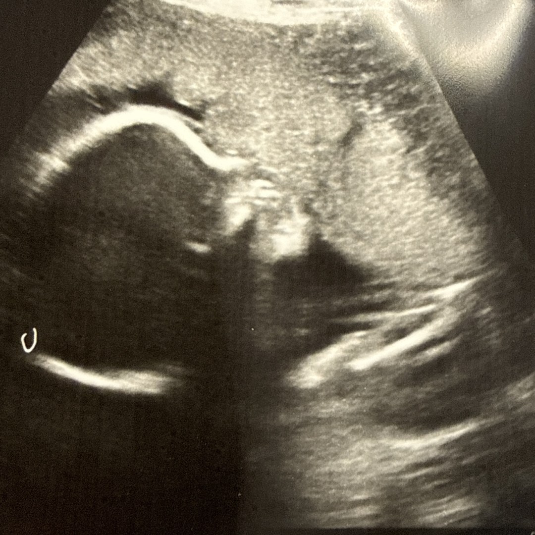Photo shared by Hilda for their Babylist baby registry.