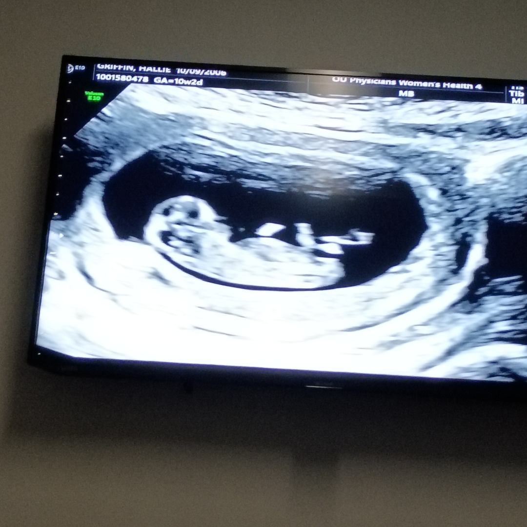 Photo shared by Hallie for their Babylist baby registry.