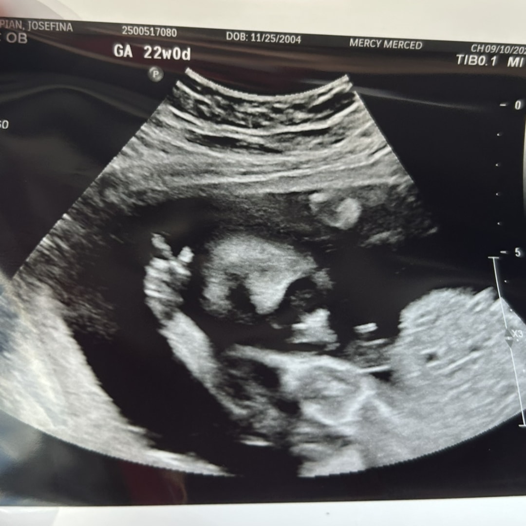 Photo shared by Josefina for their Babylist baby registry.