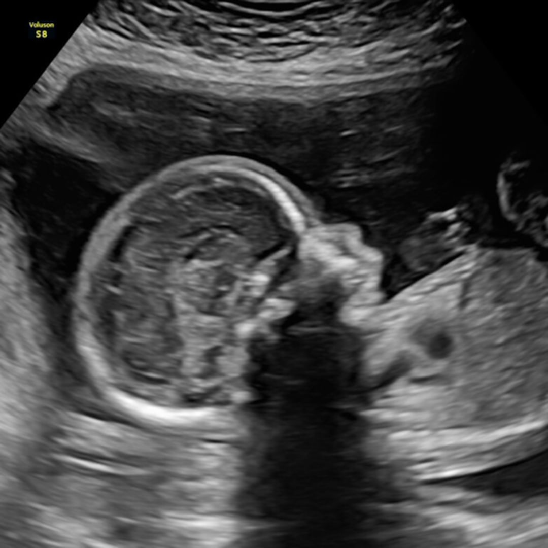 Photo shared by Kelly for their Babylist baby registry.