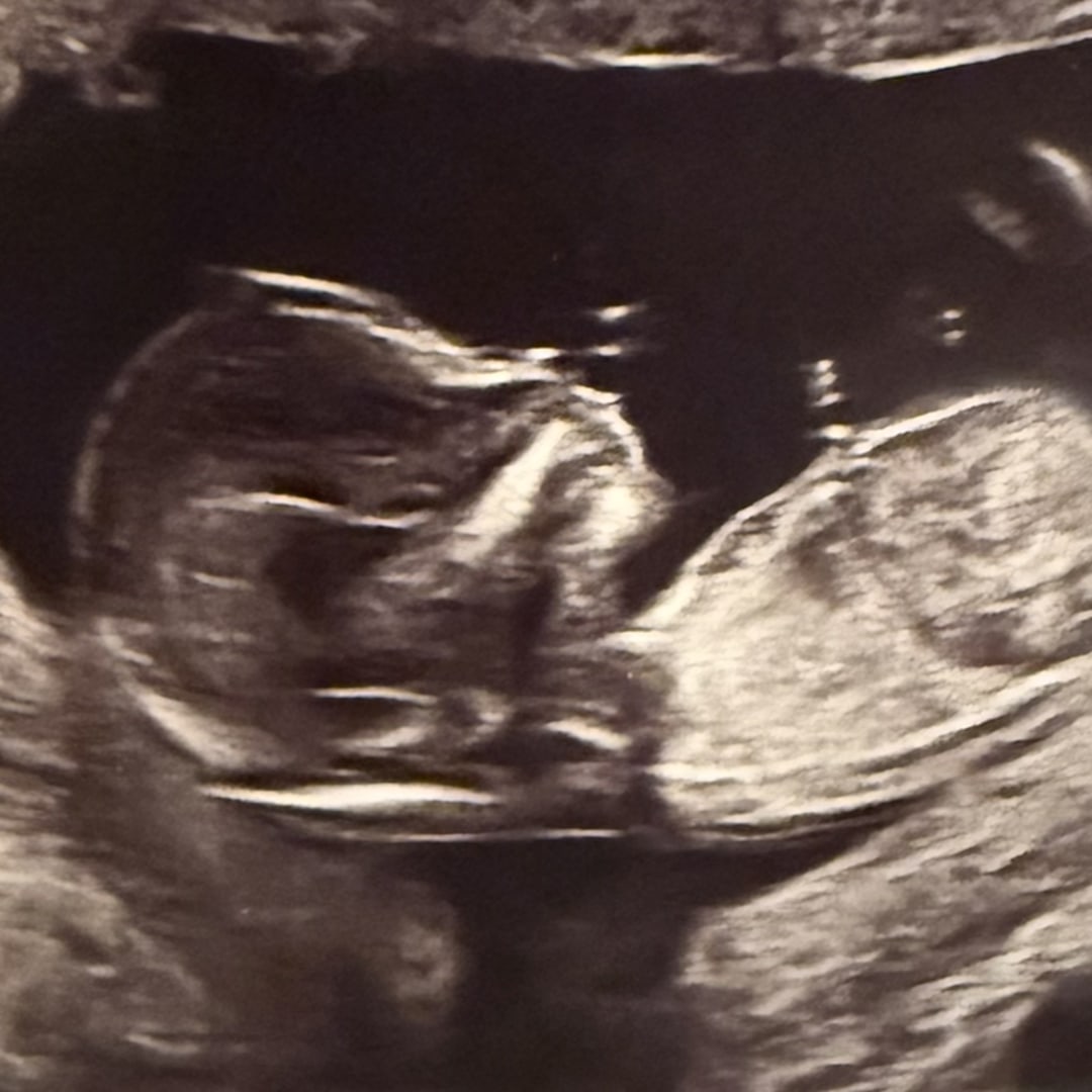 Photo shared by Kate for their Babylist baby registry.