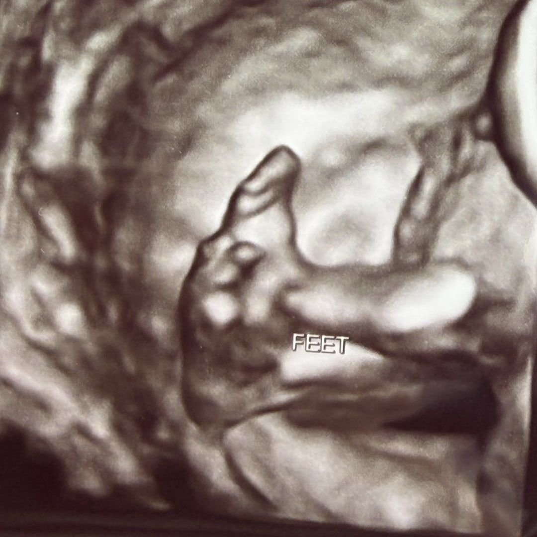Photo shared by Caitlin for their Babylist baby registry.