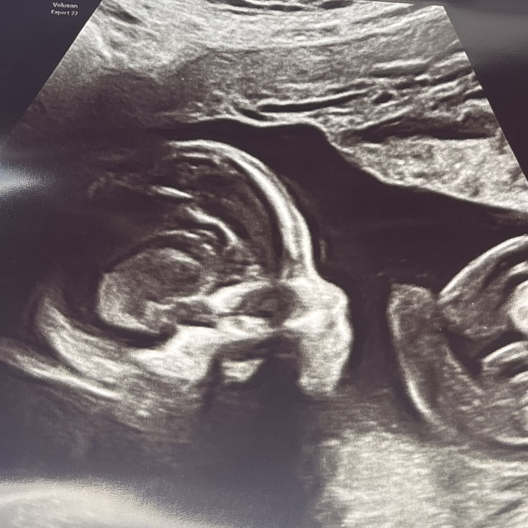 Photo shared by Erica for their Babylist baby registry.