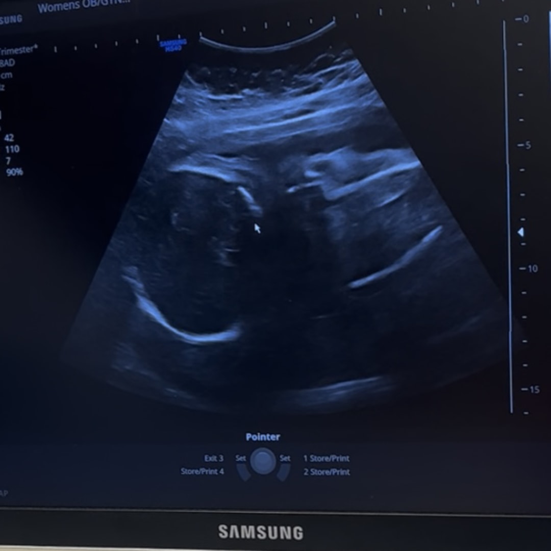 Photo shared by Krista for their Babylist baby registry.