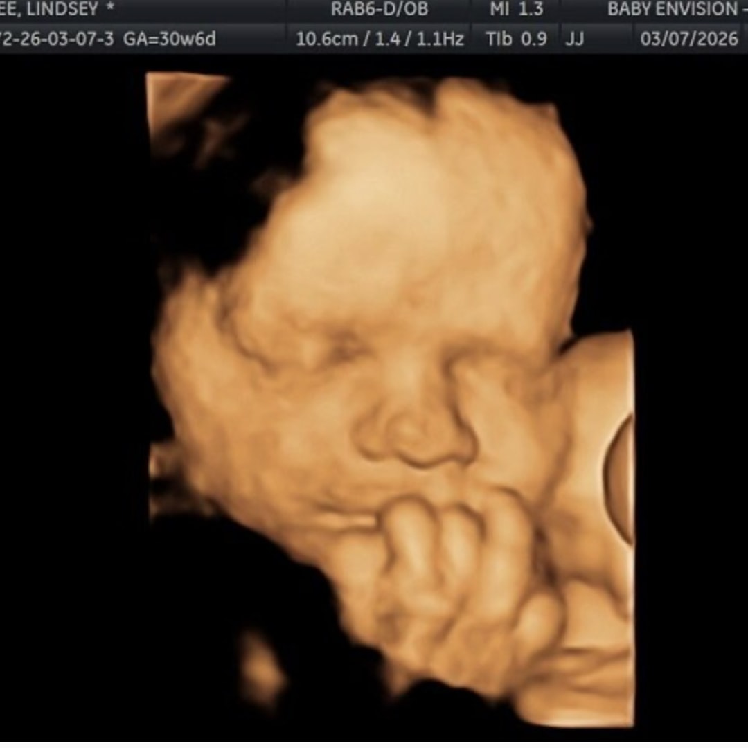 Photo shared by Lindsey for their Babylist baby registry.