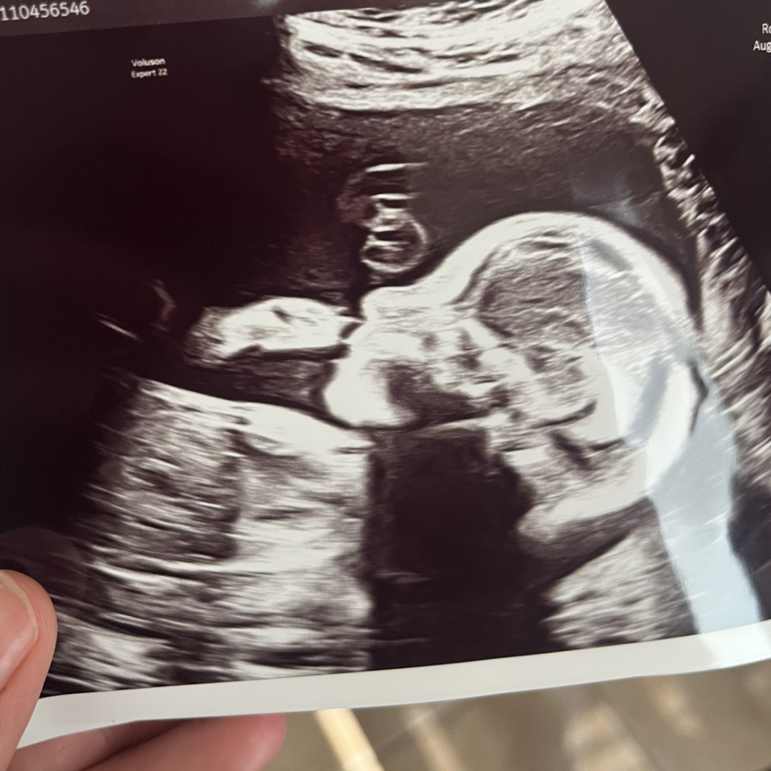 Photo shared by Brittany for their Babylist baby registry.