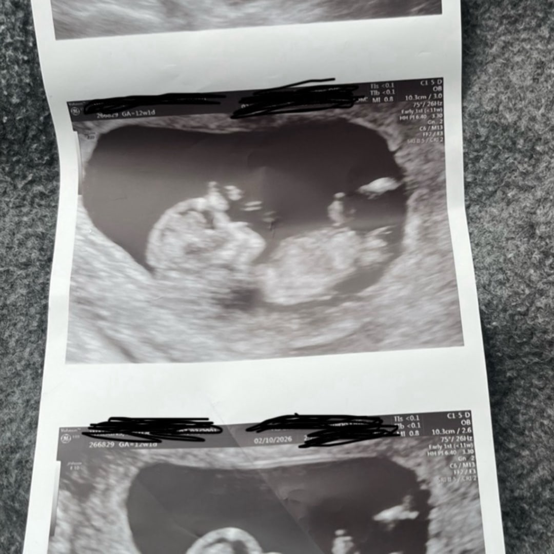 Photo shared by Antoenesha for their Babylist baby registry.