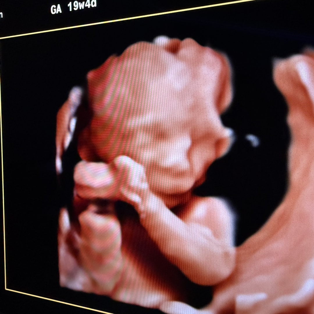 Photo shared by Alejandra for their Babylist baby registry.