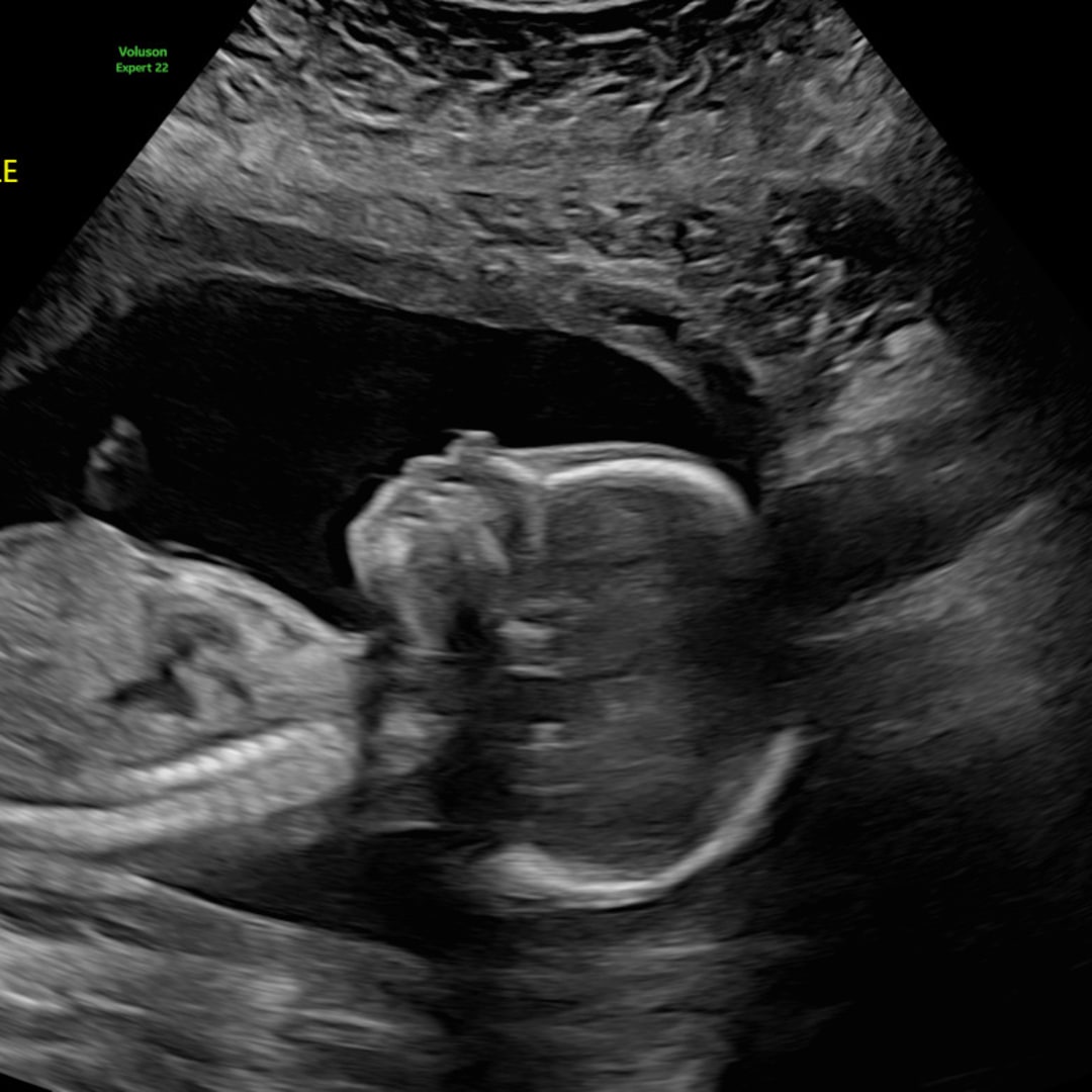 Photo shared by Kortney for their Babylist baby registry.