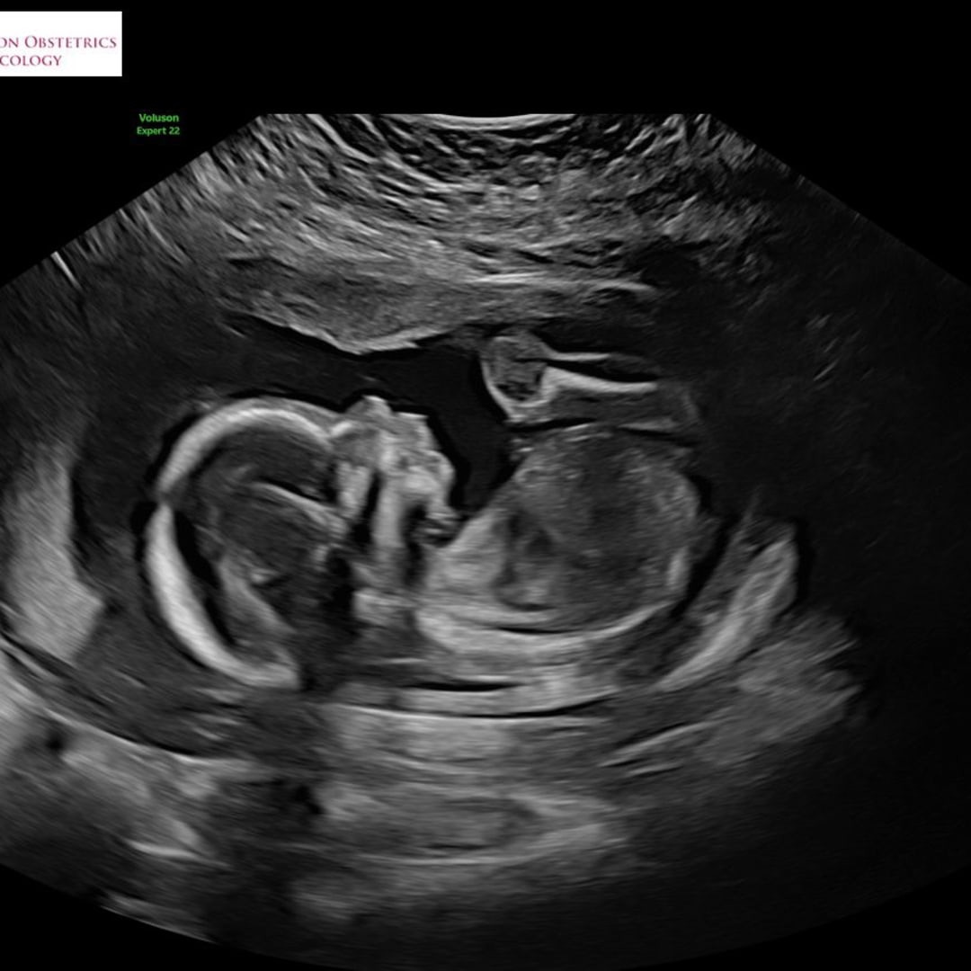 Photo shared by Aviana for their Babylist baby registry.