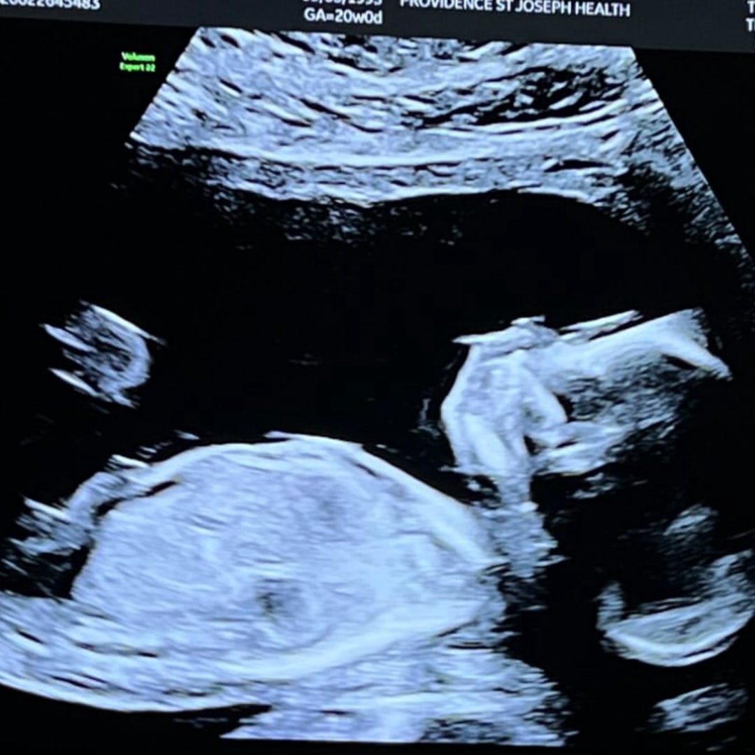 Photo shared by Wendy for their Babylist baby registry.