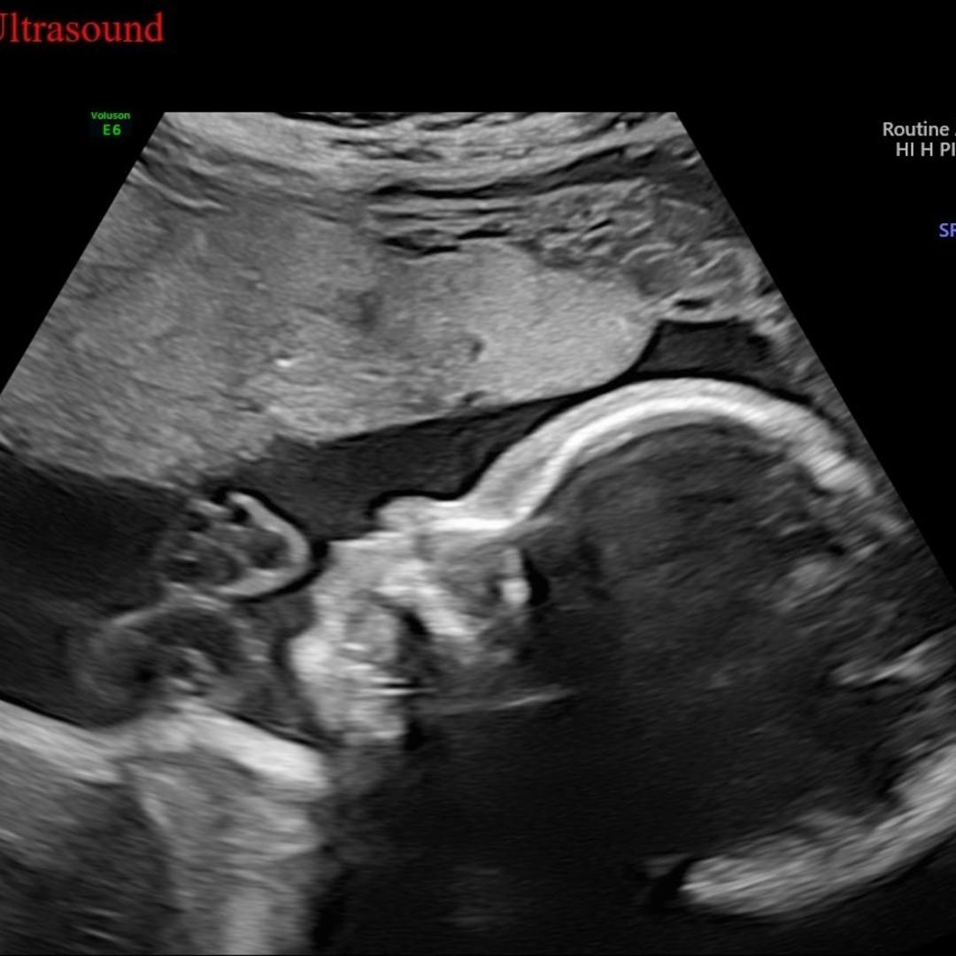 Photo shared by Abigail for their Babylist baby registry.